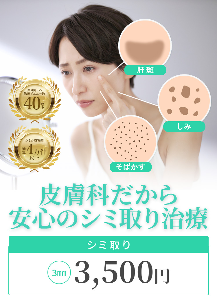 皮膚科だから安心のシミ取り治療