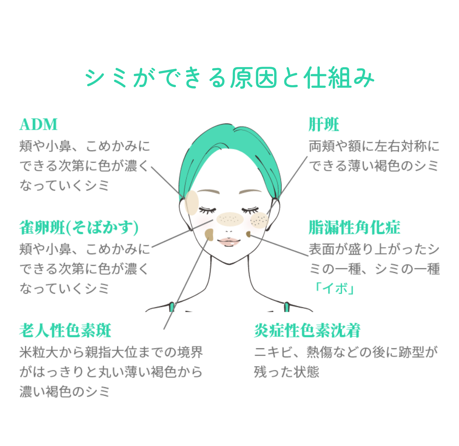シミができる原因と仕組み